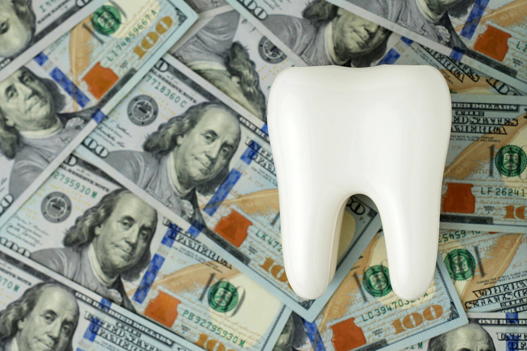 Ile kosztuje korona zęba warto wiedzieć przed wizytą u dentysty