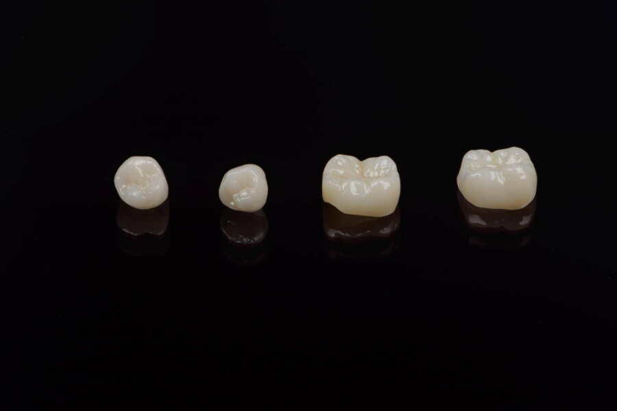 Most porcelanowy na metalu czy cyrkonie – która opcja sprawdzi się lepiej?