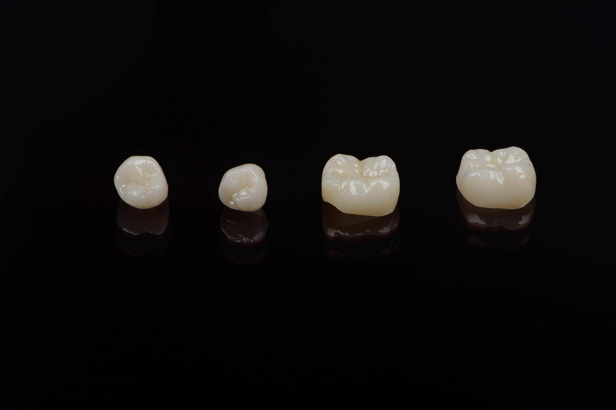 Most porcelanowy na metalu czy cyrkonie – która opcja sprawdzi się lepiej?